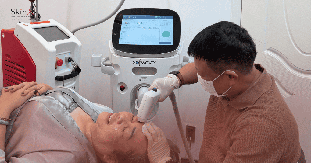 Làm Sofwave có bị mất mỡ mặt không?